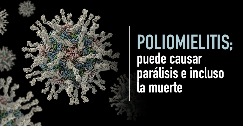 imagen del artículo Poliomielitis, puede causar parálisis e incluso la muerte