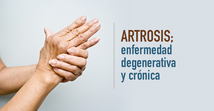 imagen del artículo Artrosis, enfermedad degenerativa y crónica