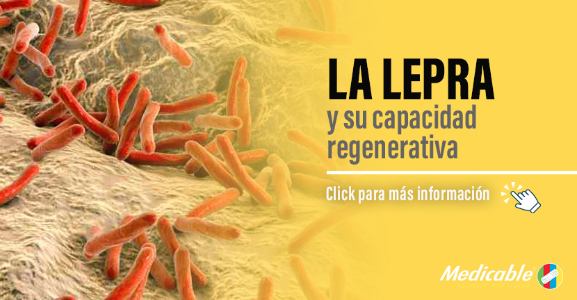 imagen del artículo La lepra y su capacidad regenerativa