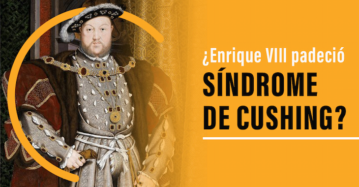 imagen del articulo ¿Enrique VIII padeció síndrome de Cushing?
