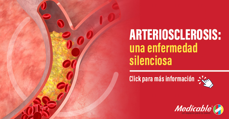 imagen del articulo Arteriosclerosis: una enfermedad silenciosa