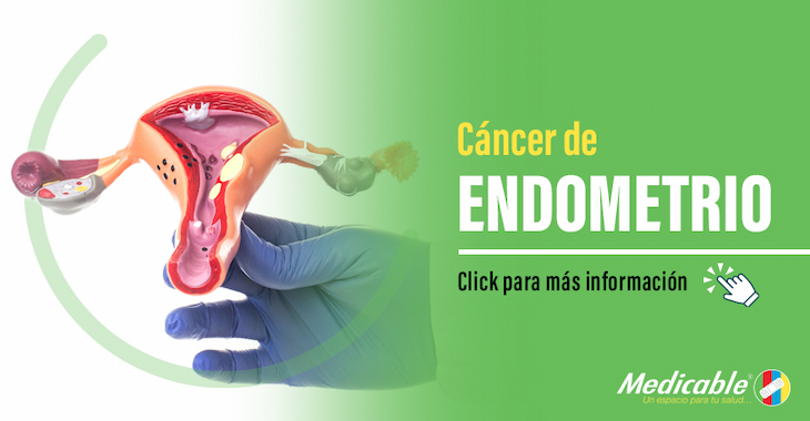imagen del articulo Cáncer de endometrio