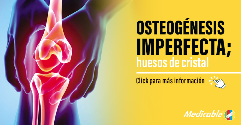 imagen del artículo Osteogénesis imperfecta; huesos de cristal.