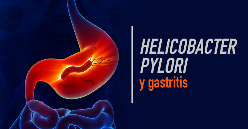 imagen del articulo Helicobacter pylori y gastritis