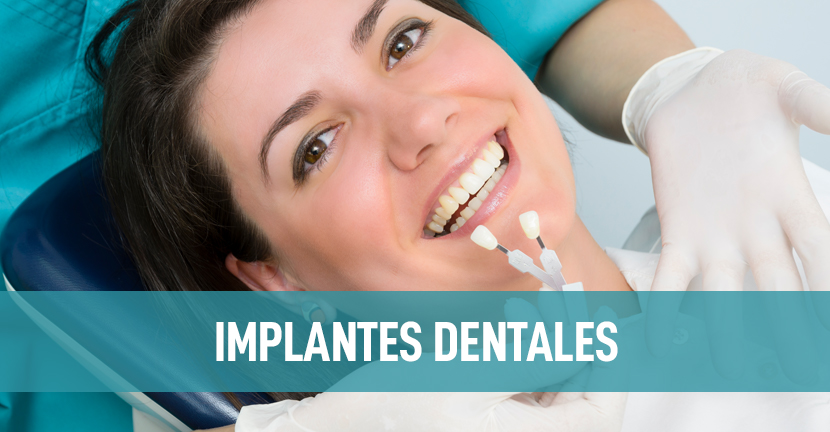 imagen del artículo Implantes dentales