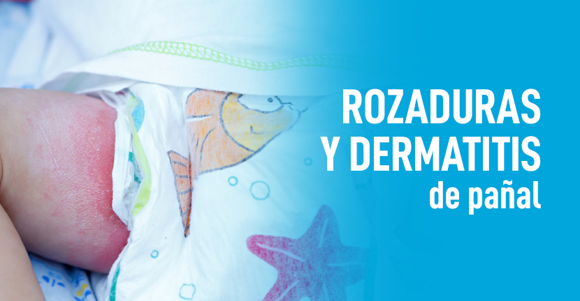imagen del articulo Rozaduras y dermatitis de pañal