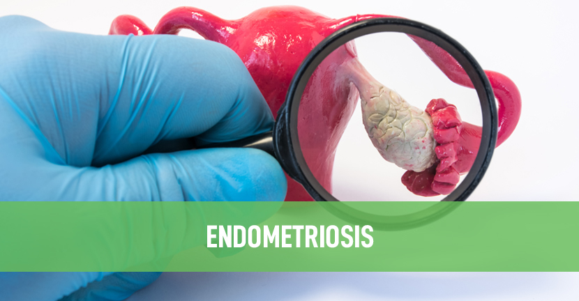 imagen del artículo Endometriosis