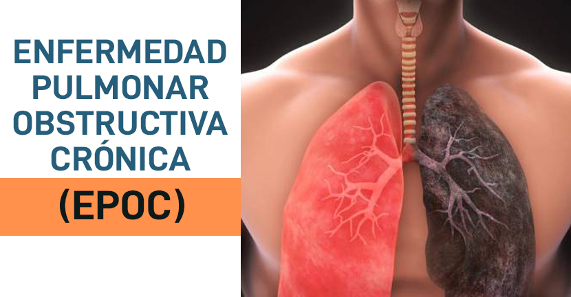 imagen del artículo Enfermedad Pulmonar Obstructiva Crónica (EPOC)