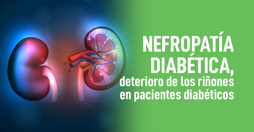imagen del artículo  Nefropatía diabética, deterioro de los riñones en pacientes diabéticos