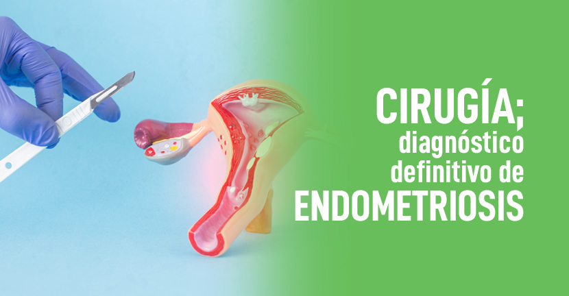 imagen del artículo Cirugía diagnóstico definitivo de endometriosis
