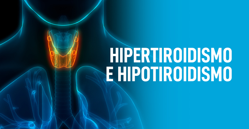 imagen del artículo Hipertiroidismo e hipotiroidismo