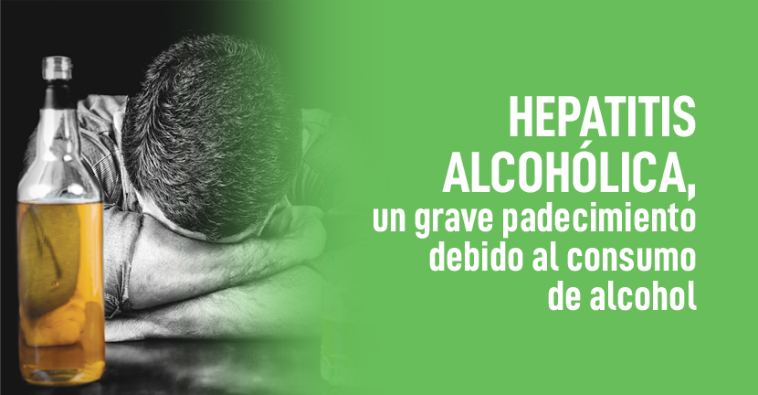 imagen del artículo Hepatitis alcohólica, un grave padecimiento debido al consumo de alcohol