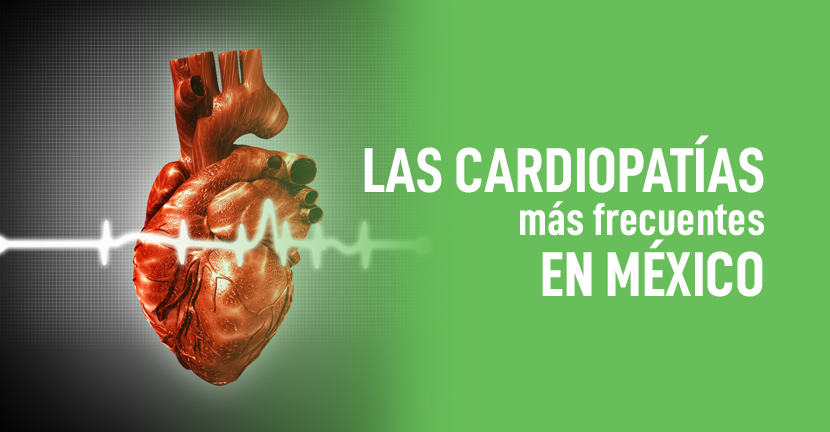 imagen del articulo Las cardiopatías más frecuentes en México