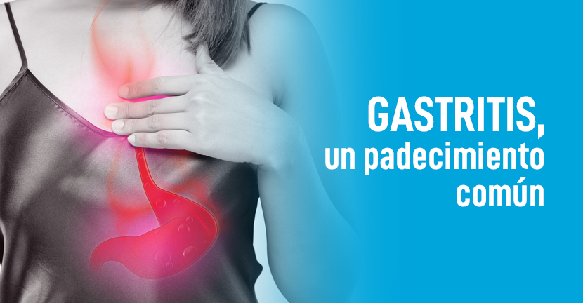 imagen del artículo Gastritis, un padecimiento común