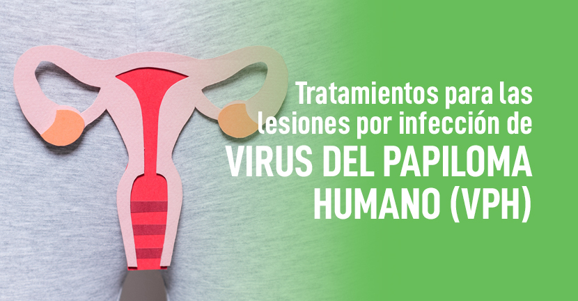 imagen del articulo Tratamientos para las lesiones por infección de Virus del Papiloma Humano (VPH)