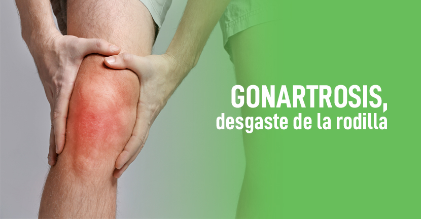 imagen del artículo Gonartrosis, desgaste de la rodilla