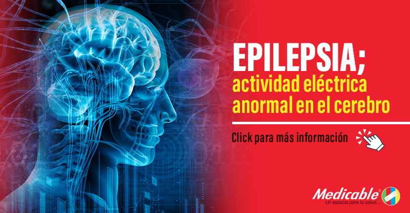 imagen del articulo Epilepsia