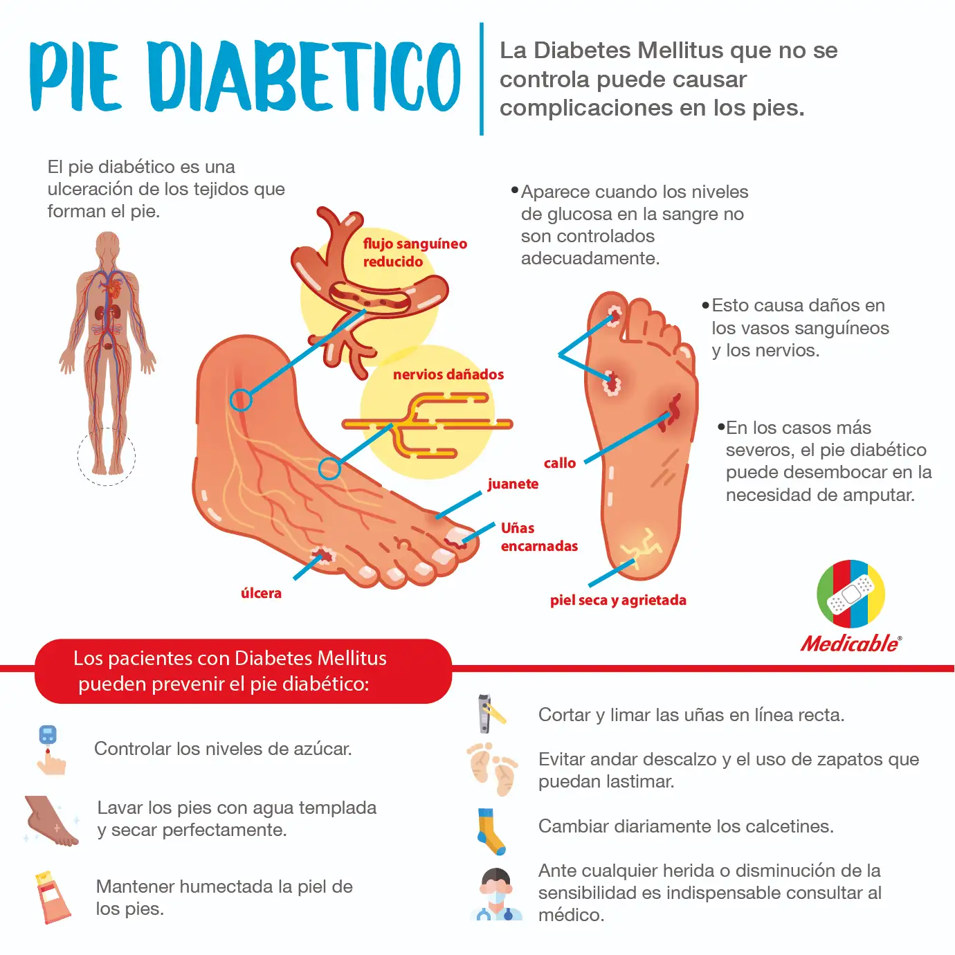 imagen del artículo Pie diabetico