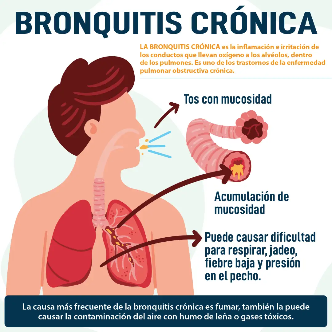 imagen del artículo Bronquitis cronica