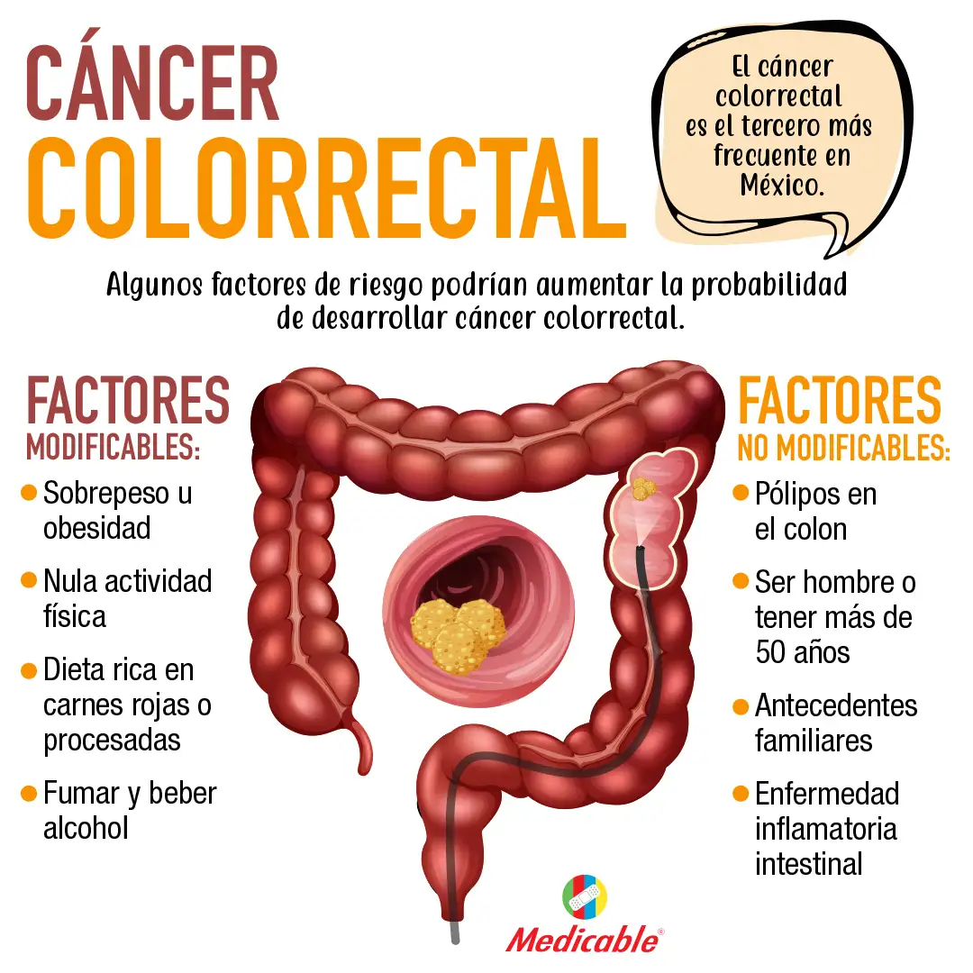 imagen de la infografia Cancer_colorrectal