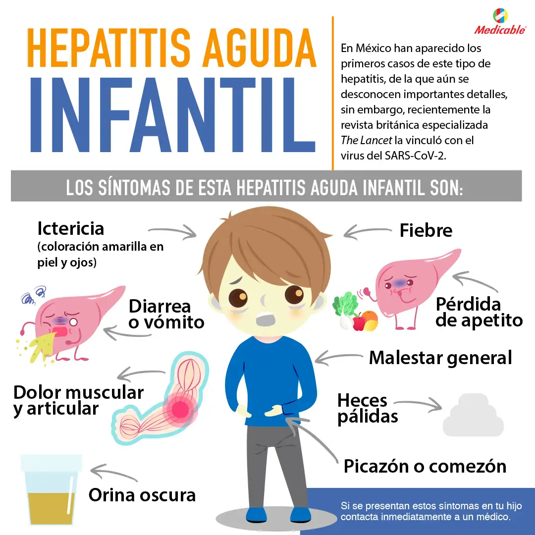 imagen del artículo Hepatitis Aguda infantil