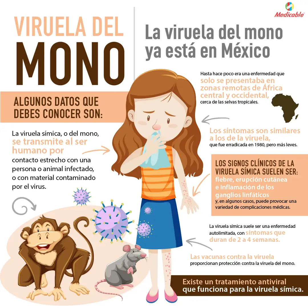imagen de la infografia Viruela del mono