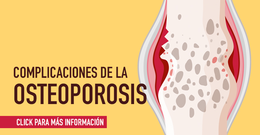 imagen de la infografia Complicaciones de la osteoporosis