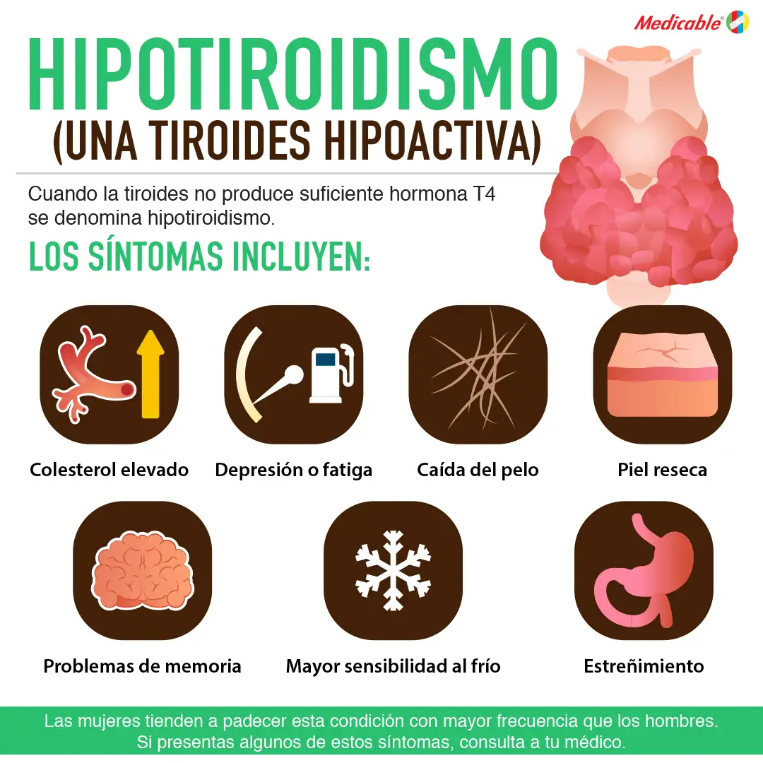 imagen del artículo Hipotiroidismo una tiroides hipoactiva