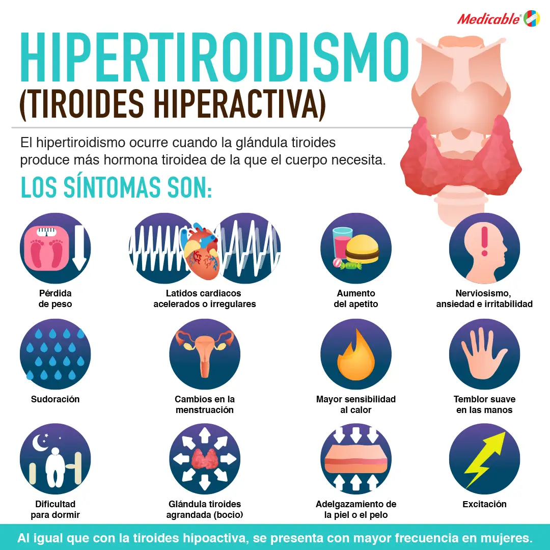 imagen de la infografia Hipertiroidismo