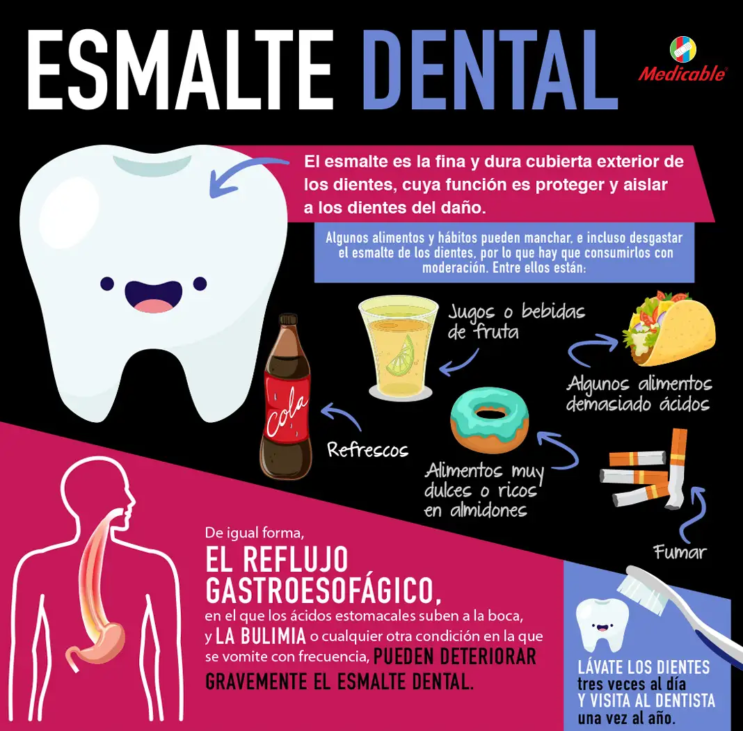 imagen de la infografia Esmalte dental