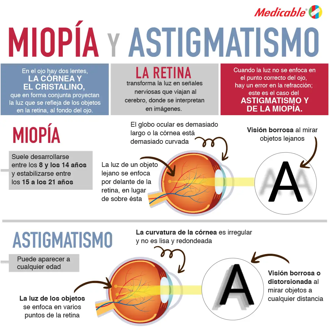 imagen de la infografia Miopía y astigmatismo