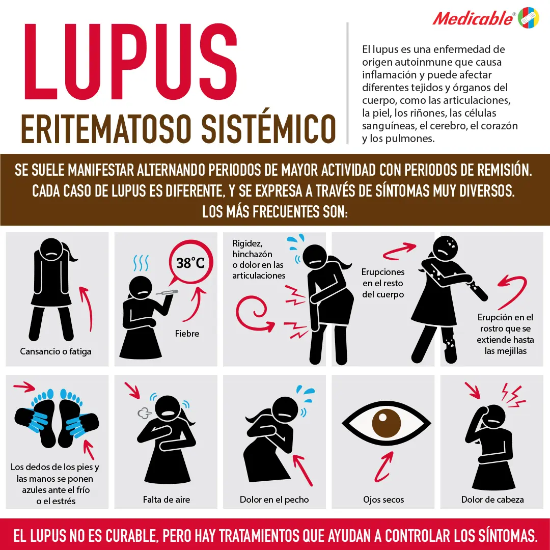 imagen de la infografia Lupus