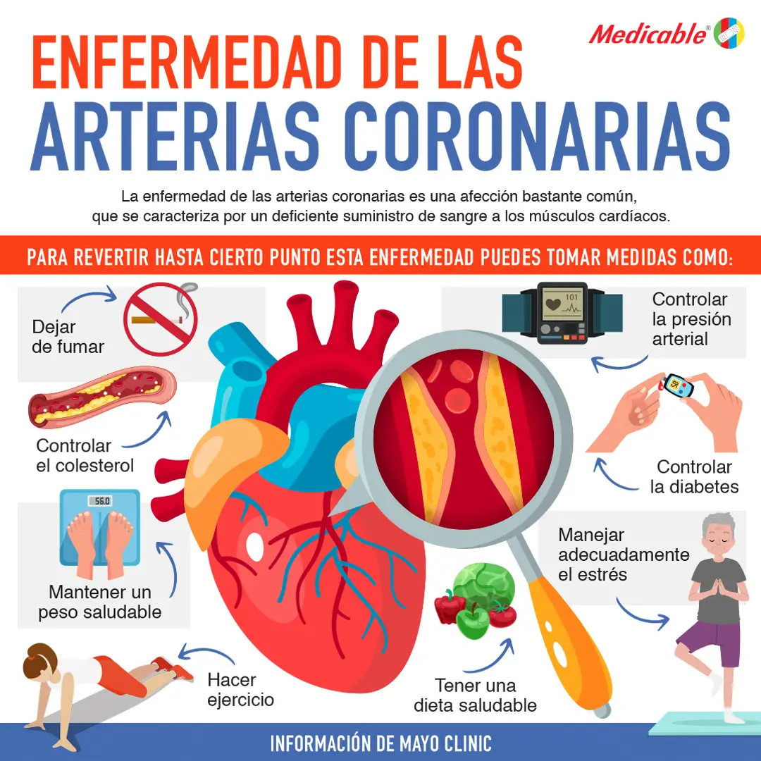 imagen de la infografia Enfermedad de las arterias coronarias