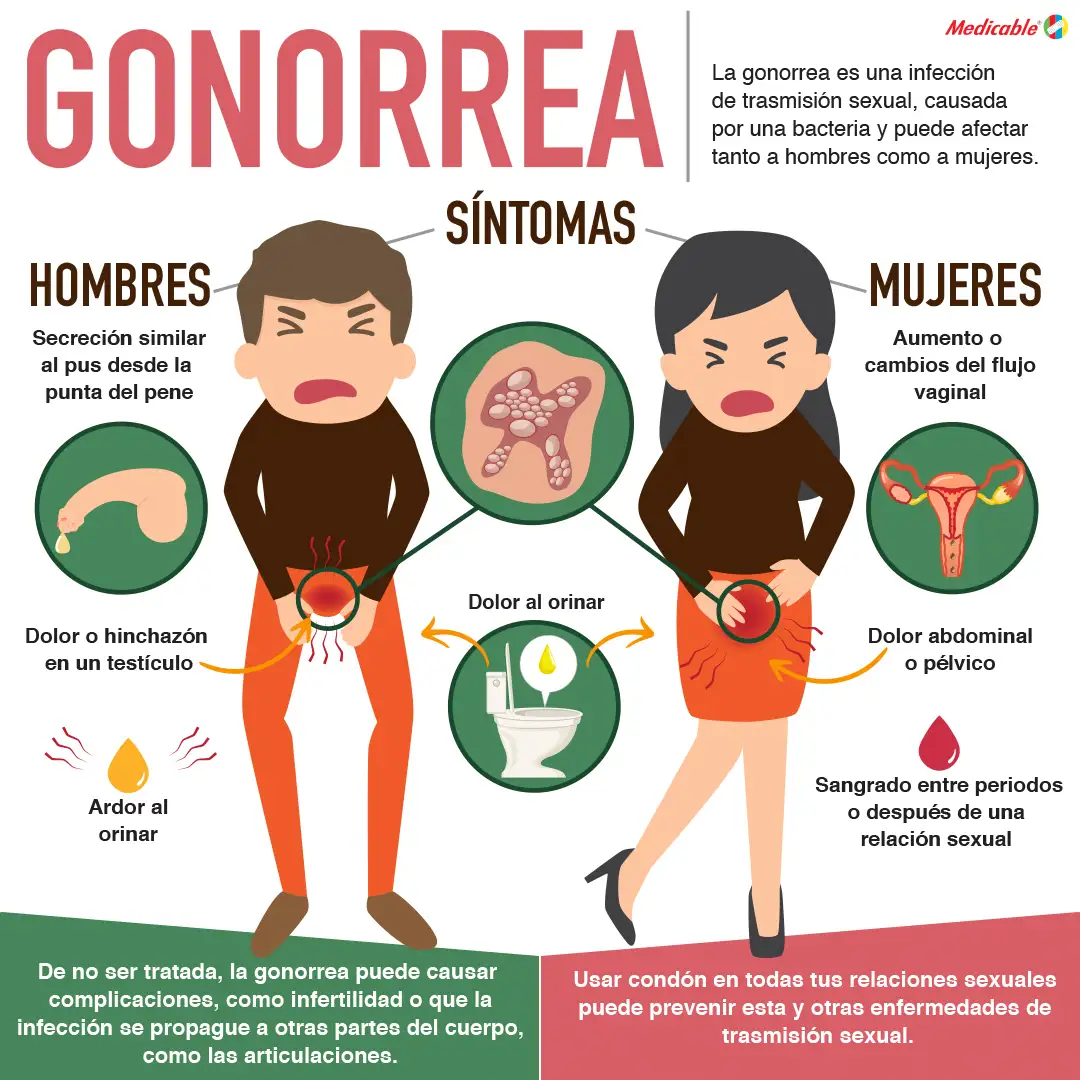 imagen de la infografia La gonorrea
