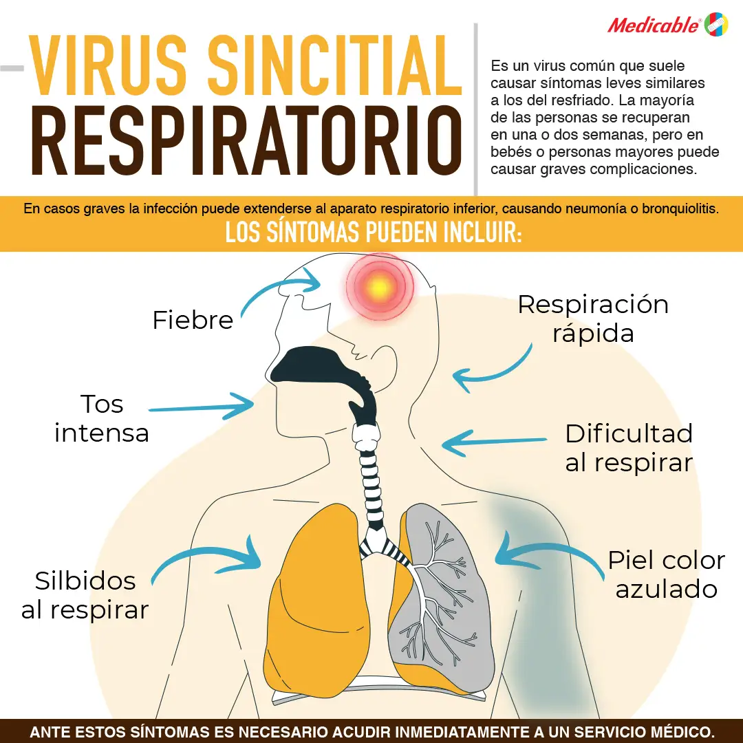 imagen del artículo Virus sincitial respiratorio