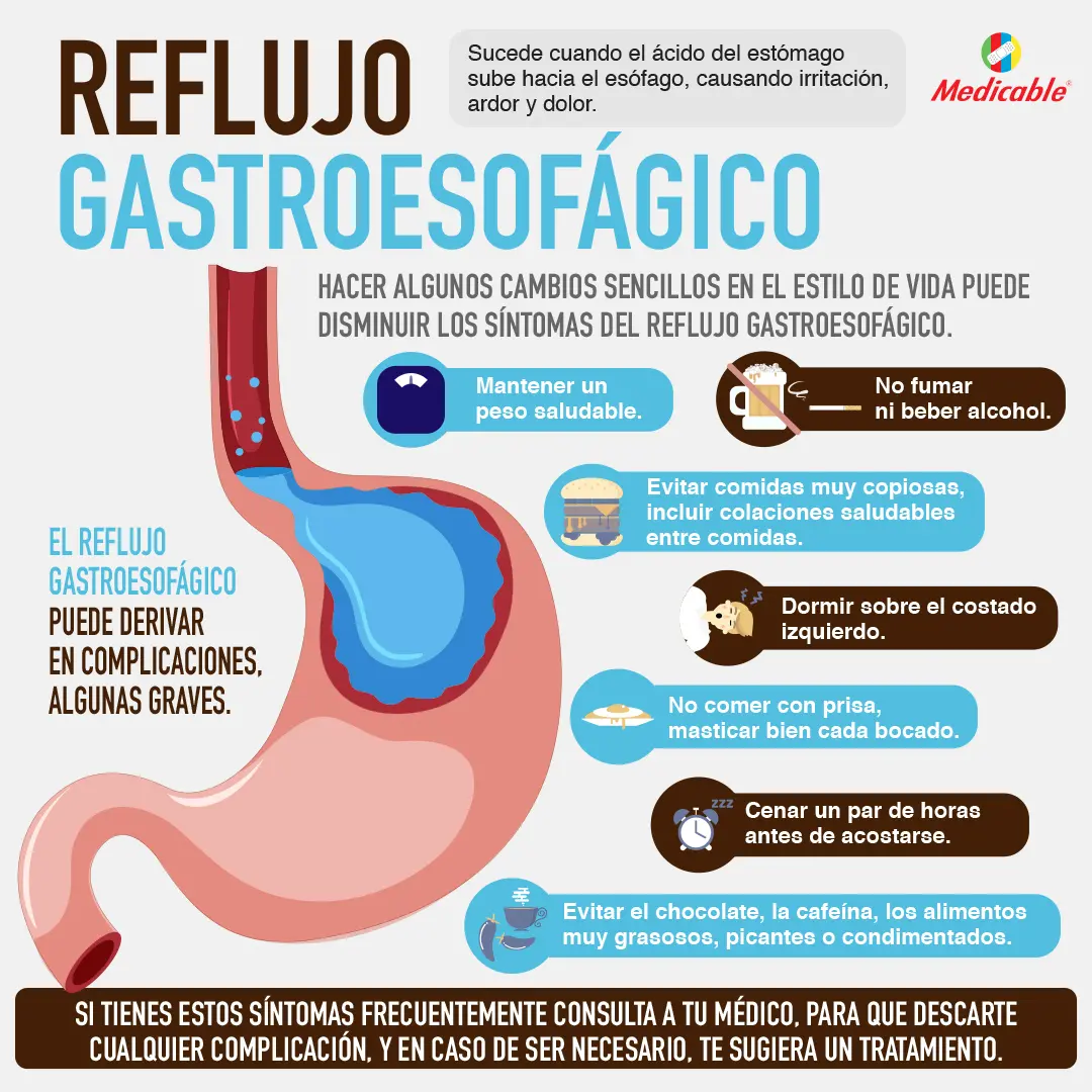 imagen de la infografia Reflujo gastroesofágico