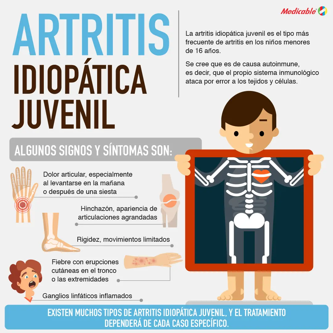 imagen de la infografia Artritis ideopática juvenil 