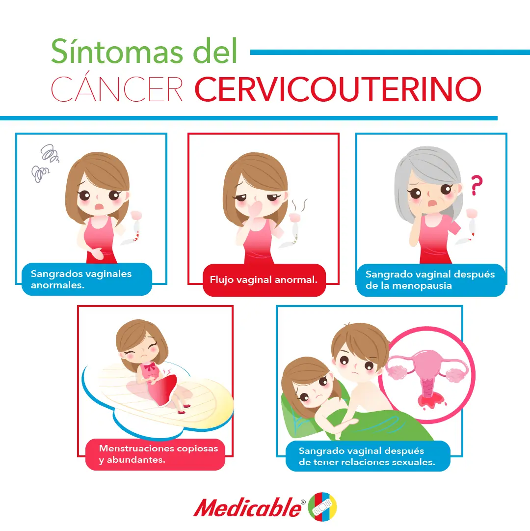 imagen de la infografia Síntomas del cáncer cervicouterino