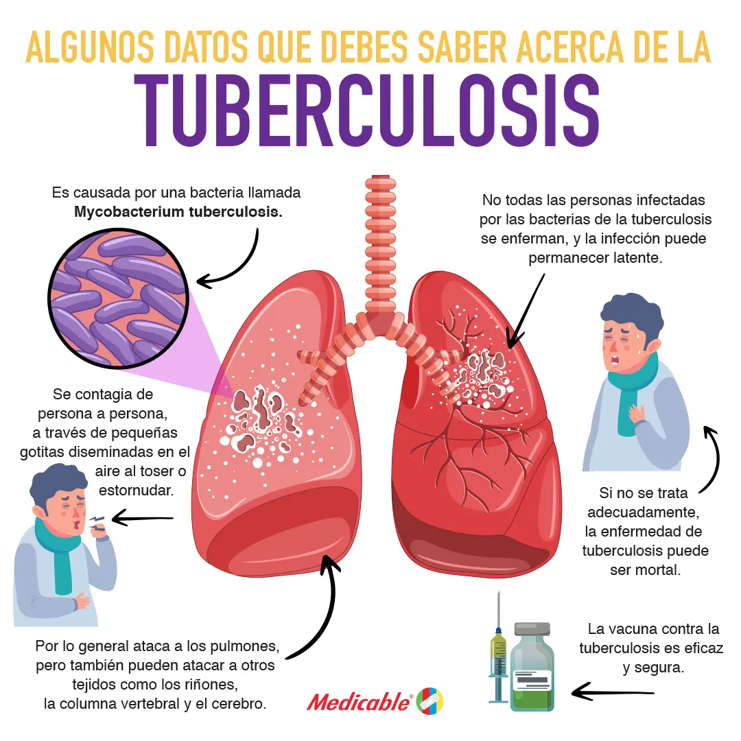imagen de la infografia Algunos datos acerca de la tuberculosis