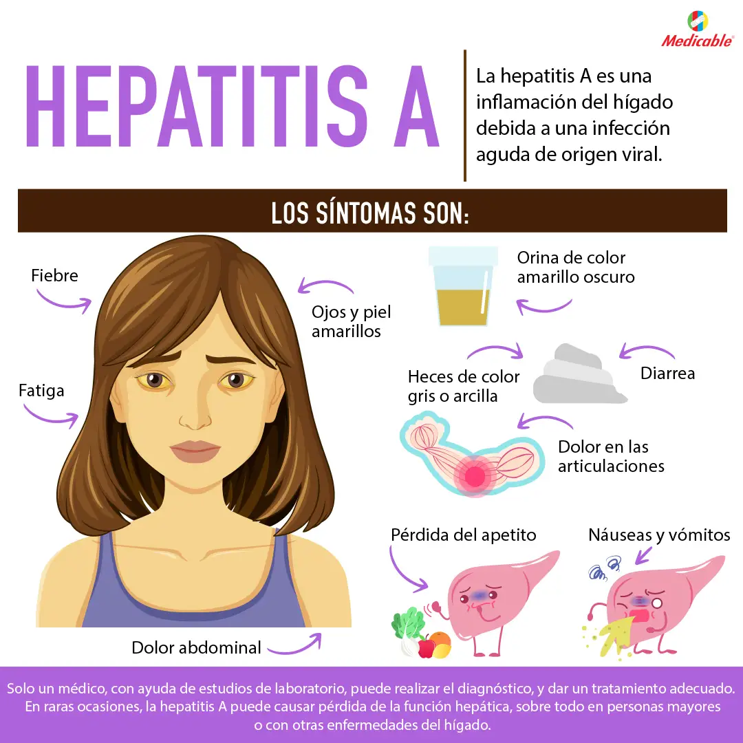 imagen de la infografia Hepatitis A