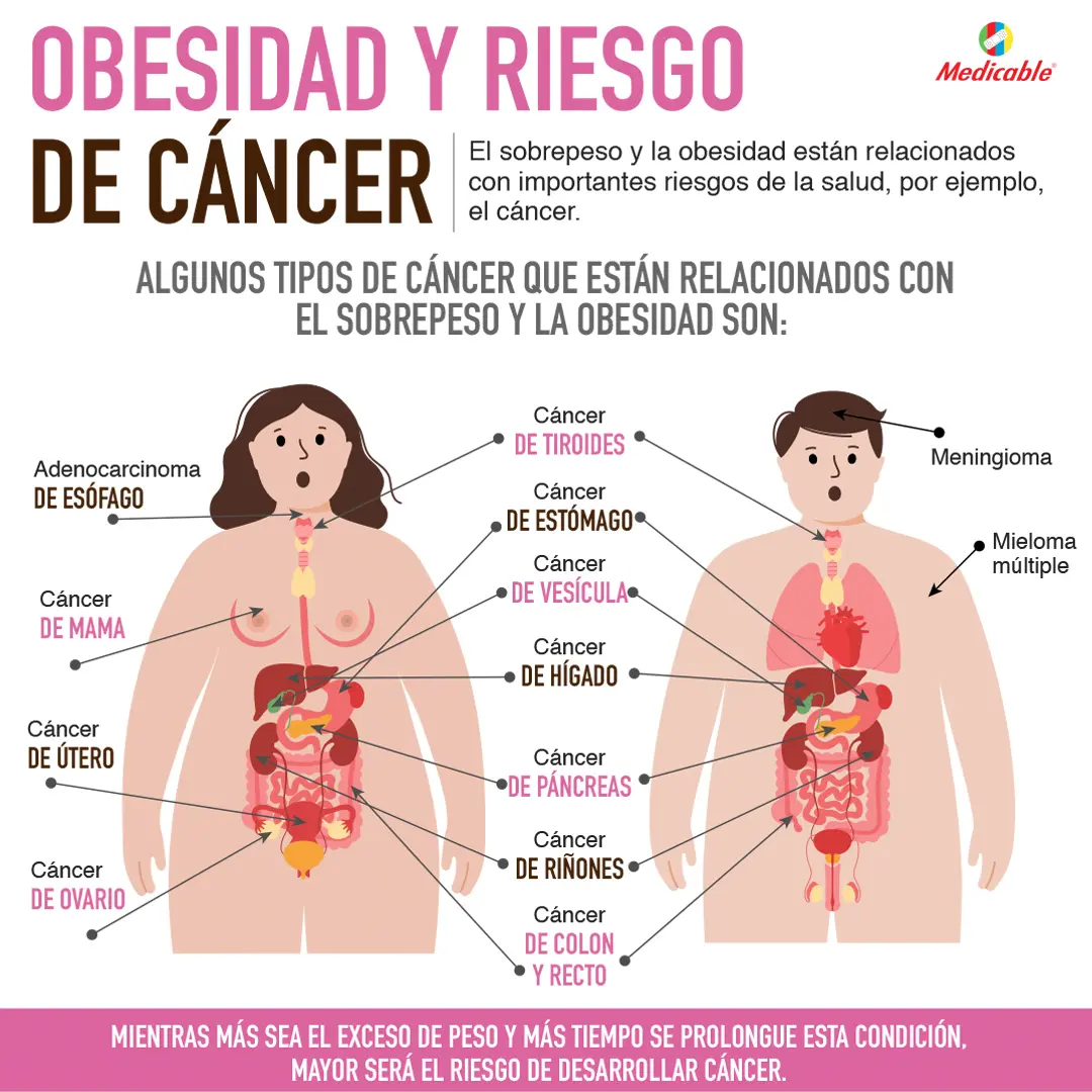 imagen de la infografia Obesidad y riesgo de cáncer