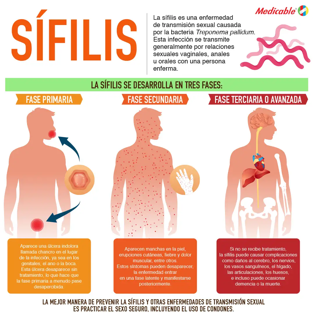 imagen de la infografia Sífilis