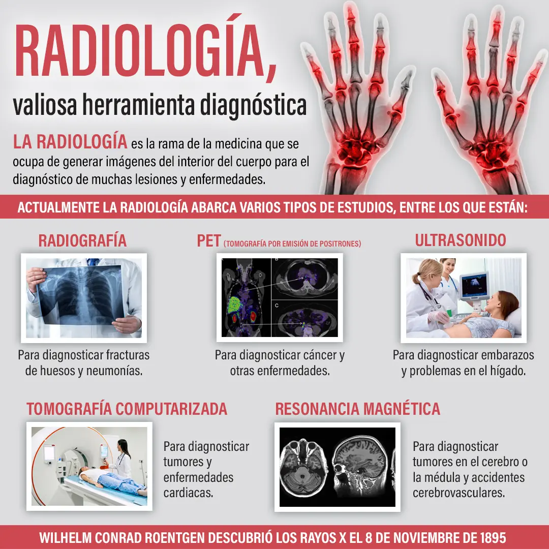 imagen de la infografia 8 de noviembre, Día Mundial de la Radiología