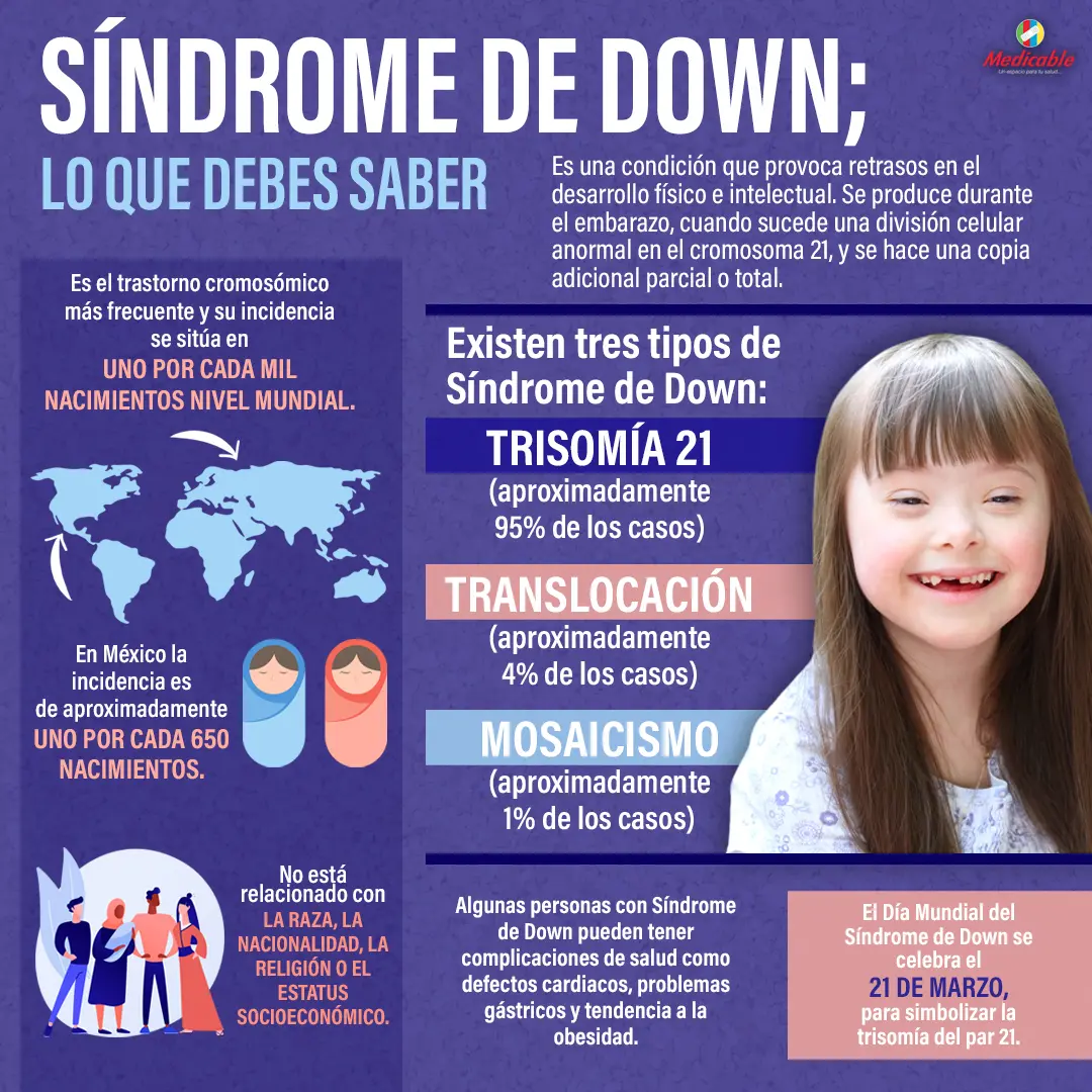 imagen de la infografia Síndrome de Down, lo que debes saber