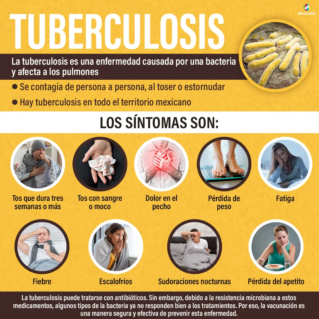 imagen del artículo Tuberculosis, enfermedad que afecta los pulmones