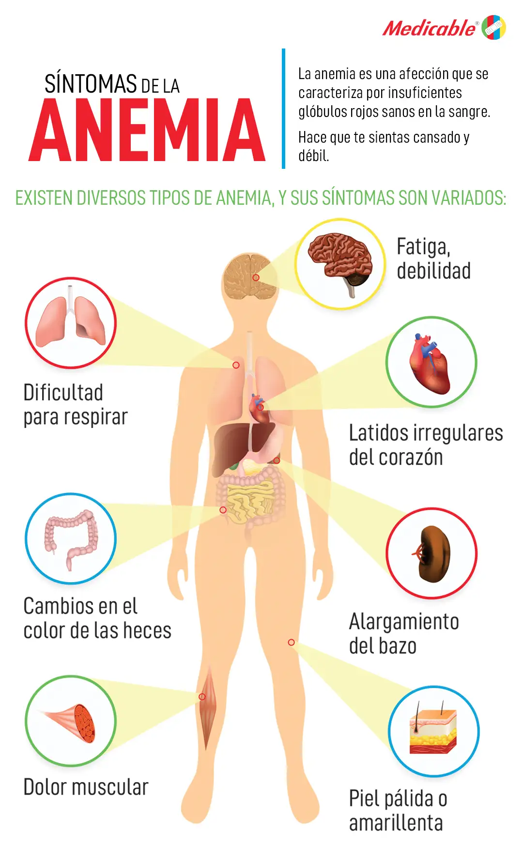 imagen de la infografia Síntomas de la anemia