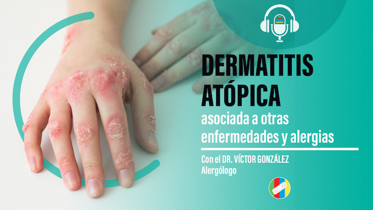 imagen del artículo Dermatitis Atópica