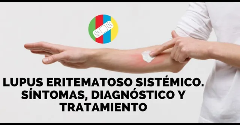 imagen del video LUPUS ERITEMATOSO SISTÉMICO. Síntomas, diagnóstico y tratamiento