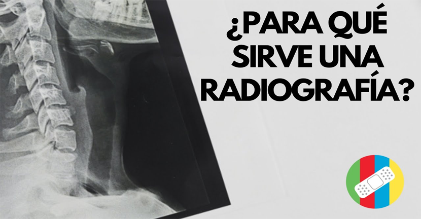 imagen del video ¿Para qué sirve una radiografía?