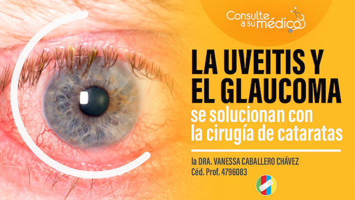 imagen del video ¿La uveítis y el glaucoma se solucionan con la cirugía de cataratas?